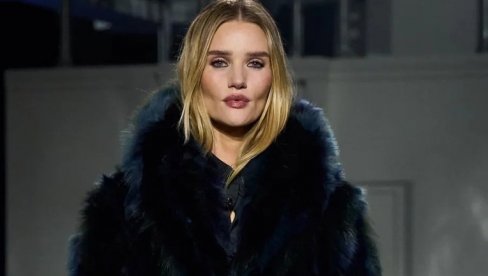 ZAŠTO CEO SVET PRIČA O ROUZ HANTINGTON-VAJTLI? Ovako izgleda lice žene koja je sebe uništila preranim i nepotrebnim botoksom!