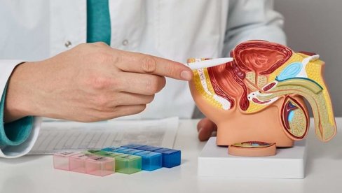 За аденом простате ласерска хирургија Тулијумом од 200 вати  решење је без компромиса