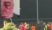 SKANDAL TRESE REGION! Fudbaleri Željezničara brutalno pretukli fotografa Sloge