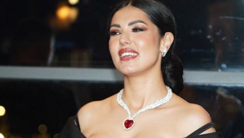 МОЈЕ ТЕЛО ТО НЕ ПОДНОСИ ДОБРО: Тања Савић искрено о естетским операцијама - признала шта је све радила на себи