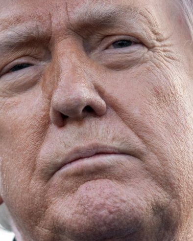 Лекар открио истину о Трамповом стању: Два проблема
