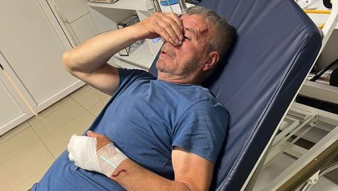 PRETUČEN SRBIN IZ KOSOVSKOG POMORAVLJA DOK JE POKUŠAO DA ZAŠTITI SINA: Pretrpeo brutalan napad od strane lokalnog Albanca