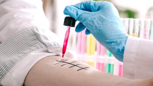 ALERGIJE SE POJAVLJUJU I U ZRELIM GODINAMA Savet stručnjaka: Prvo uradite kožne testove, pa antigen iz krvi