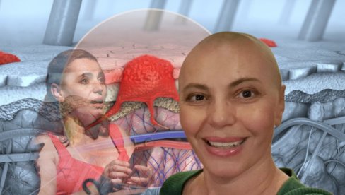 KRVARIM, PATIM, NEMOĆ ME SLAMA... Naša glumica o borbi sa opakom bolešću: Ne umem da se odbranim