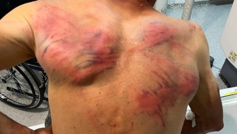 ЈЕЗИВО! Куртијеви полицајци тукли Србина: Везали га за дрво па се иживљавали (ФОТО)