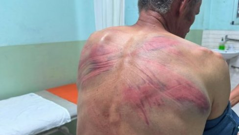 СУСПЕНЗИЈА ПОЛИЦАЈАЦА НИЈЕ ДОВОЉНА ЗА ТАКАВ ЗЛОЧИН Симић: Потребна одговорност пред судом