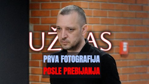 JEZIVA SLIKA: Vidite kako Zoran Marjanović izgleda posle prebijanja - pištoljem u glavu (FOTO)