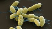 NOVI SMRTONOSNI VIRUS U RUSIJI? Istraživačica umrla od upale pluća nepoznatog porekla, hitno se oglasili iz Amerike