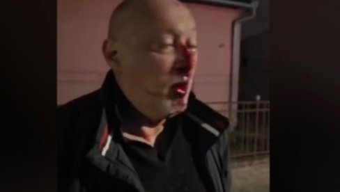 BLOKADERI KRVNIČKI PRETUKLI ČOVEKA: Razbili mu nos i slomili vilicu (VIDEO)