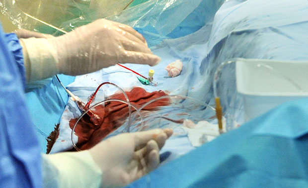 Нигеријски гувернер и Тачи тргују људским органима?
