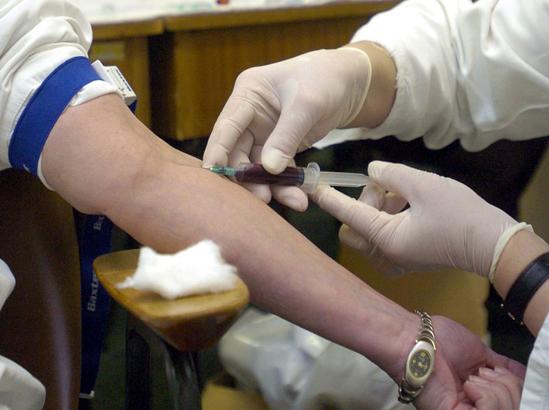 У Србиjи око пола милиона људи заражено вирусом хепатитиса