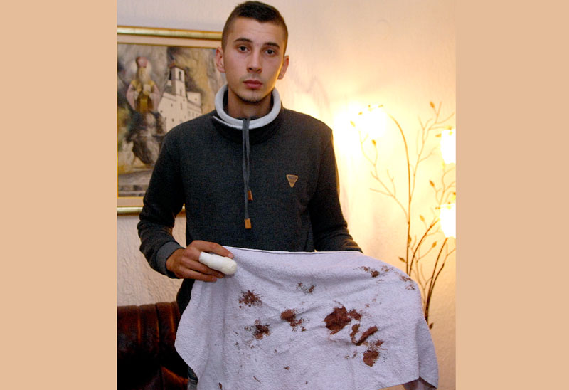 Исекао прст на послу, па му дали отказ?!