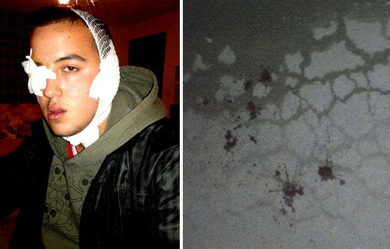 На српске дечаке летвама са ексерима!