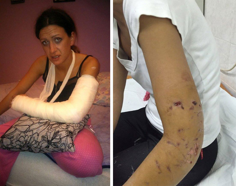 Стафорд и питбул изуједали девојку