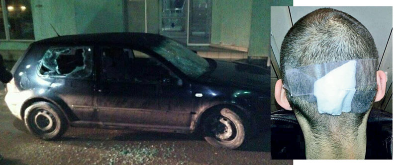 Севале песнице, секире и ланци