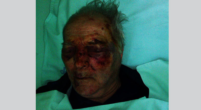 Пожаревац: Познаници претукли старца па му отели 10.000 €!