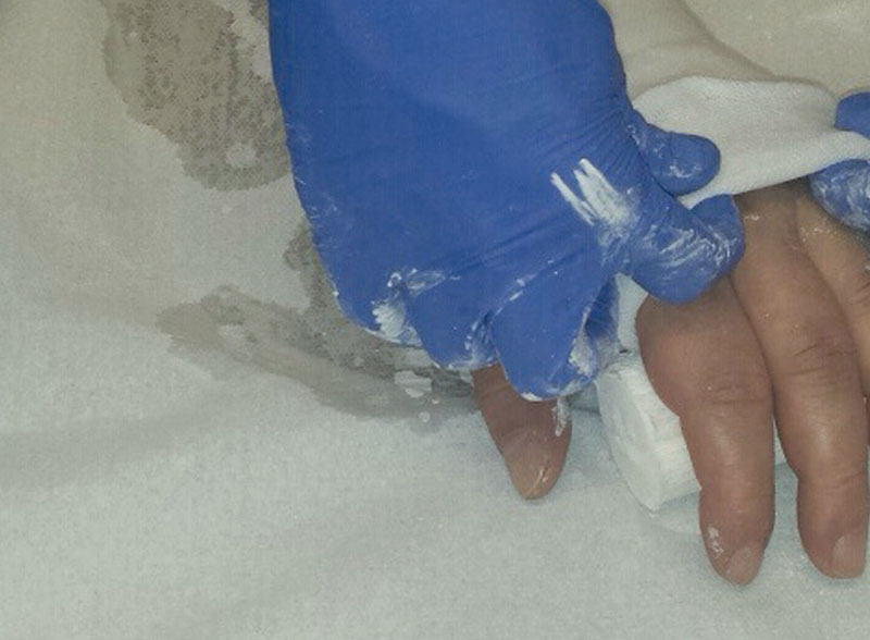 Дечаку због петарди ампутиран врх прста!