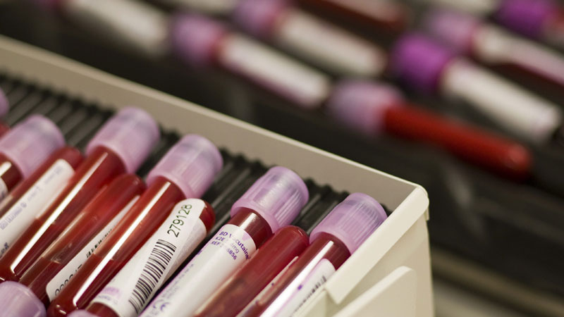 Адидас тражи од ИААФ додатне информације о допингу