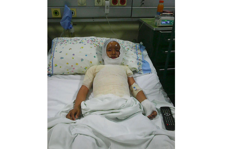 Ватром писао име, па запалио дечака!