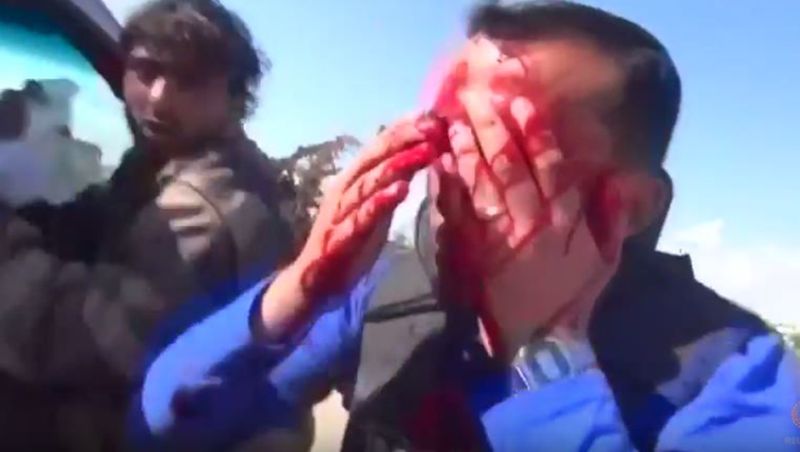 УЗНЕМИРУЈУЋИ ВИДЕО: Новинара у Сирији током снимања погодио гелер у главу