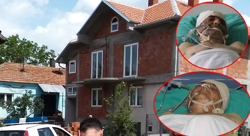 Претучени отац и ћерка се боре за живот!