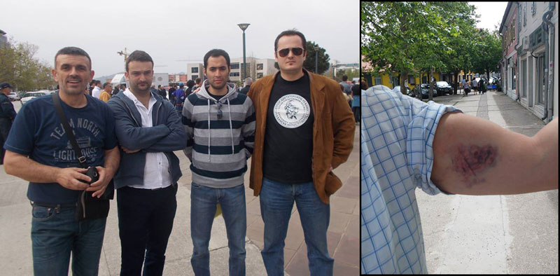 Никшић: Пендреком по целом телу!