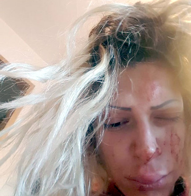 БРАВО ЗА ОВО, МУШКАРЧИНЕ!: Српска певачица брутално претучена?!