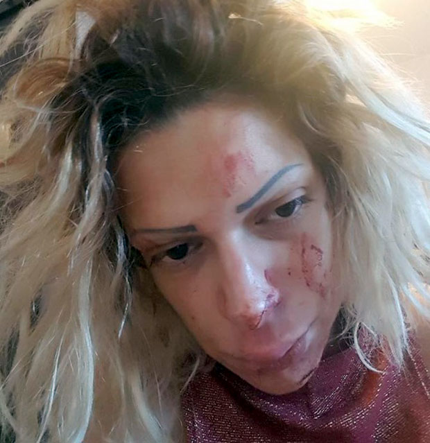 Дуња Илић открила због чега је нападнута: Највише су ме болеле увреде мојих!