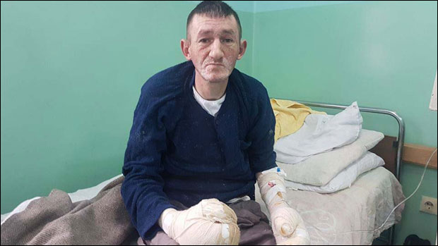 Промрзлима видају ране