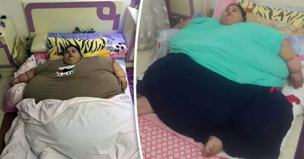 ФОТО: Жена од пола тоне иде на операцију за смањивање тежине