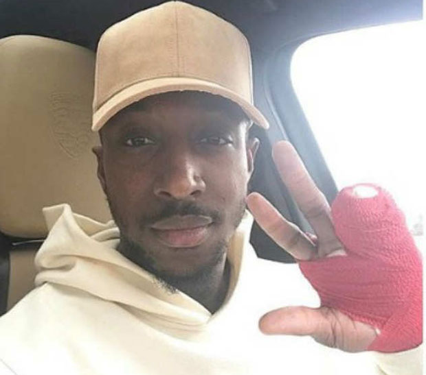 Везиста Звезде зарадио тежу повреду леве шаке: Доналда ни прелом не зауставља