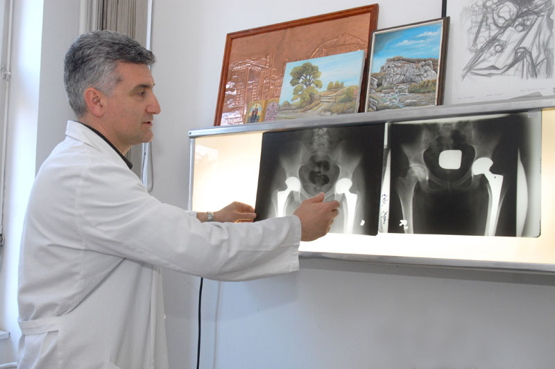 Стижу вештачки зглобови