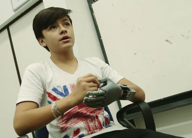 ВИДЕО: Дечак сам себи направио протетичку шаку