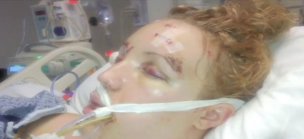 Девојку бивши дечко избо 32 пута, а удала се за болничара који јој је спасио живот