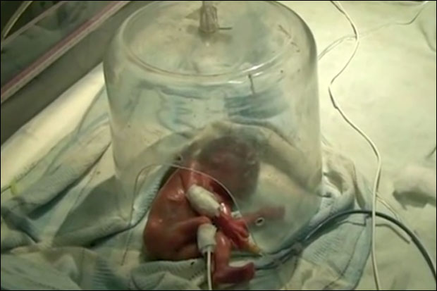 ЈЕЗИВО: Умало да сахране живо новорођенче! (ВИДЕО)