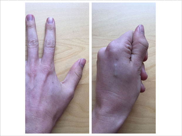 БУДУЋНОСТ ЈЕ СТИГЛА: Све више људи уграђује микрочипове под кожу