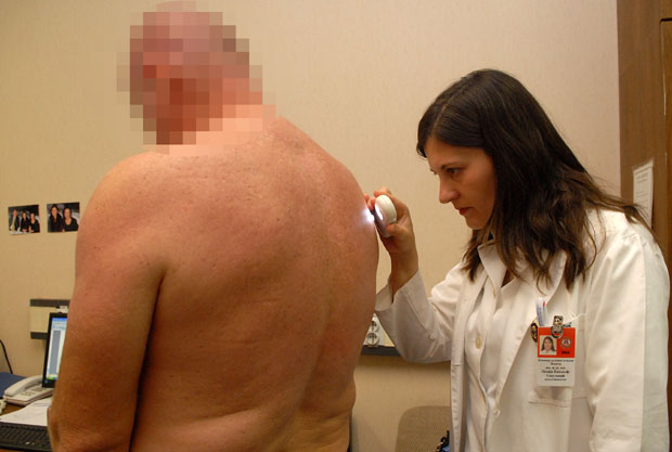 БЕСПЛАТНИ ДЕРМАТОЛОШКИ ПРЕГЛЕДИ: Акција ВМА за рано откривање рака коже