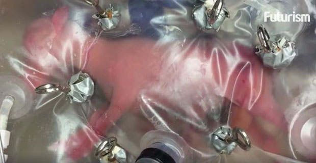 Вештачка материца ускоро и за бебе (ВИДЕО)