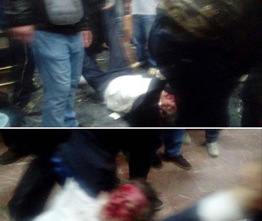 Албански посланик тешко рањен; Албанци на друштвеним мрежама: Ако умре, добићете грађански рат