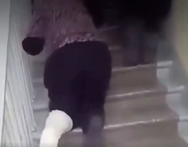 БРУКА У БОЛНИЦИ: Жена се спуштала четвороношке низ степенице 20 минута да би јој снимили ногу (ВИДЕО)