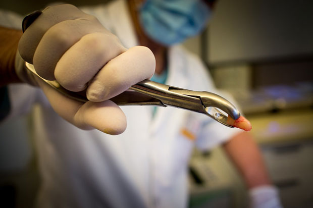 Зубар преварант извадио 22 здрава зуба