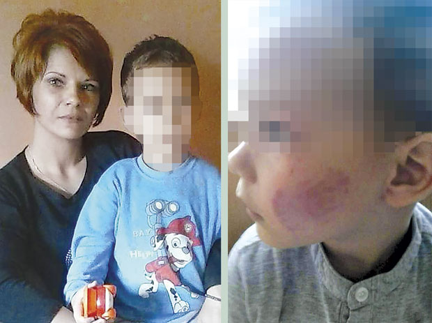 Трогодишњак уједен 11 пута?!