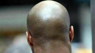 СТРАШАН ВАРВАРИЗАМ: Секу главе ћелавима да би нашли злато