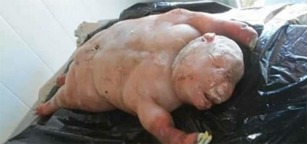 ВЕШТИЧАРЕЊЕ ИЛИ ОБИЧНА ДЕФОРМАЦИЈА: Овца донела на свет “полу-човека, полу-јагње” (ВИДЕО)