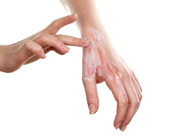 САВЕТ: Oпекотину у млаку воду