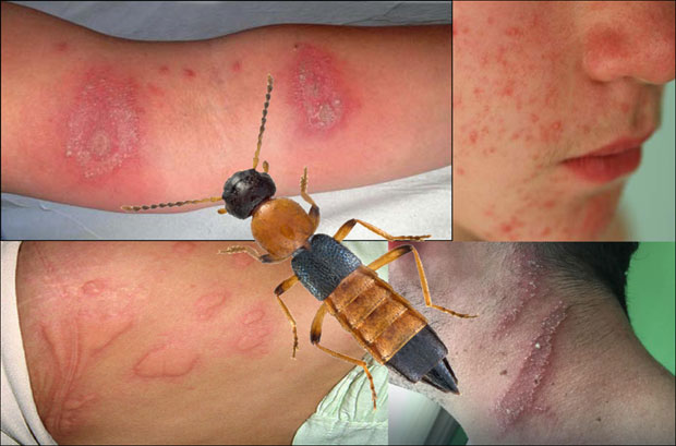 ПЕДЕРУС НАПАДА СРБИЈУ: Чим покушате да га се отарасите, БАЦА ОТРОВ НА ВАС!