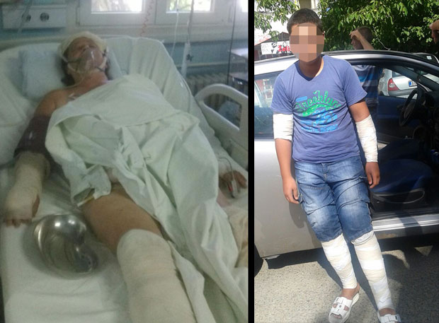 Житељи Барајева у страху након напада паса