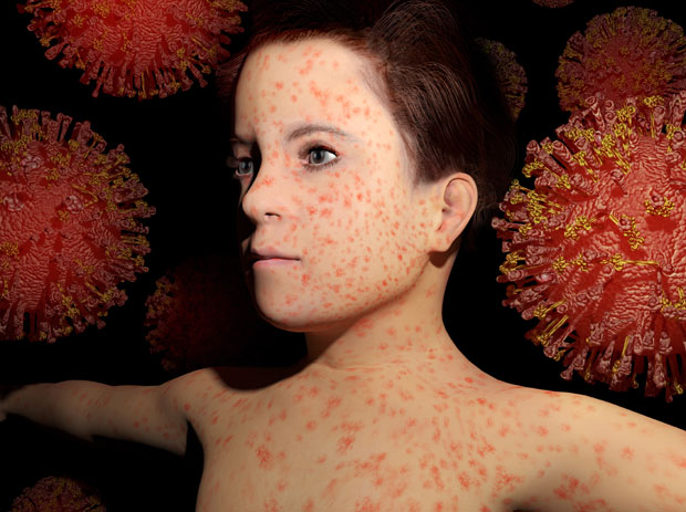 Допунска вакцинација за децу која нису заштићена