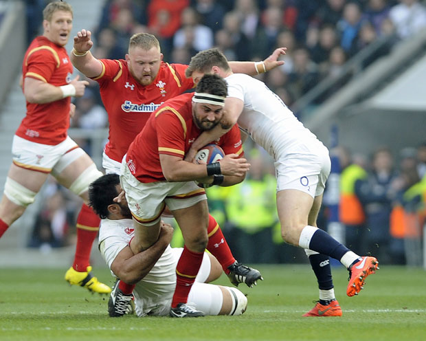 ЛУДОСТ РАГБИСТЕ: Болдвин мазио лава, па замало остао без руке (ФОТО+ВИДЕО)