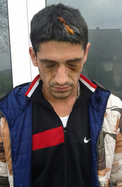 Претучен секиром због свађе око детета